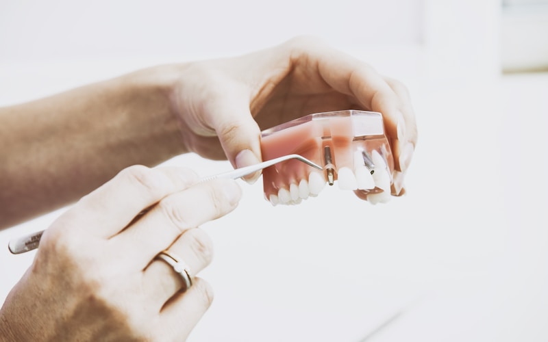 Dental implants